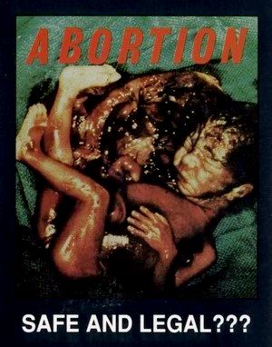 The abortion issue remains as an unhealed
     angry wound in the body politic of America